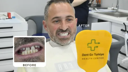 Antes e depois do tratamento dentário