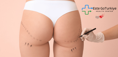 2️⃣ Contorno Corporal e Proporção