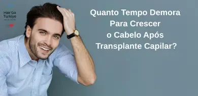 Quanto Tempo Demora Para Crescer o Cabelo Após Transplante Capilar?