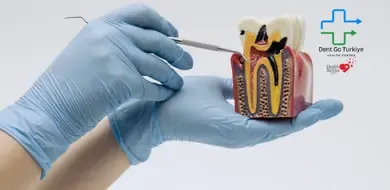 Obturação vs. Tratamento de Canal: Qual é Necessário?