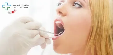 Como Criar o Melhor Plano de Tratamento Dentário para Pacientes Internacionais