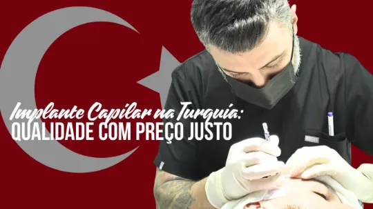 Implante Capilar na Turquia: Baixo Custo com Máxima Qualidade é Possível?