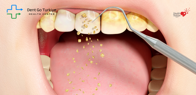😬 4. Amarelamento dos Dentes e Comprometimento Estético
