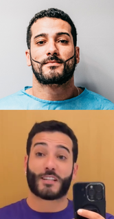 Satisfação do paciente refletida no sorriso após o tratamento bem-sucedido
