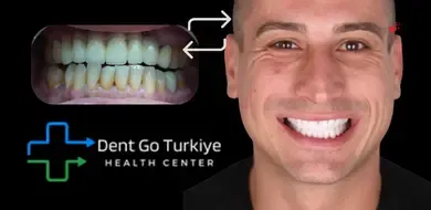 Tratamento Dentário na Turquia
Sorrisos Estéticos e Saudáveis