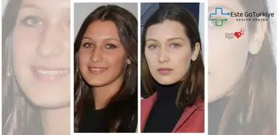 Quais Cirurgias Estéticas os Famosos Preferem?