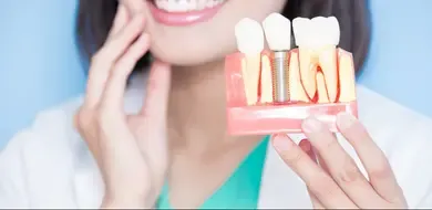 Quanto tempo dura um implante dentário? Tudo o que você precisa saber