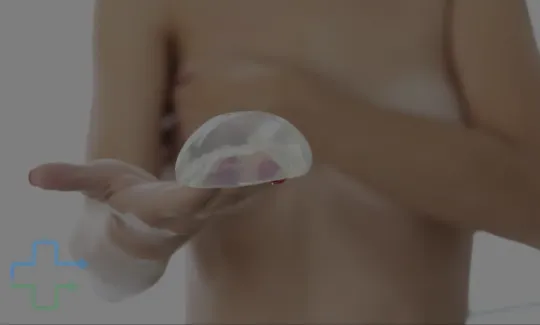 Mastopexia com ou sem prótese?
Guia de decisão