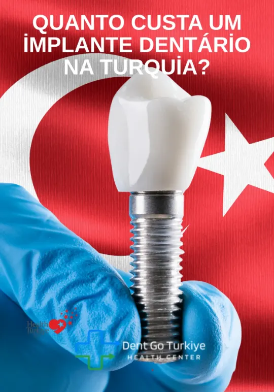Quanto custa um implante dentário na Turquia