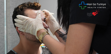 Recupere Sua Autoestima com Transplante Capilar | HairGo Clinic