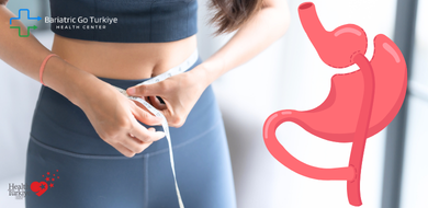 O Que é a Cirurgia de Bypass Gástrico?