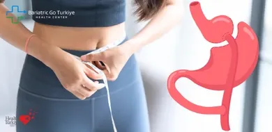 Cirurgia Bariátrica 2026: Quem Prefere e Por Quê?