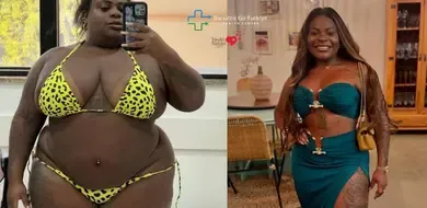 A Transformação de Jojo Todynho Após a Cirurgia Bariátrica: