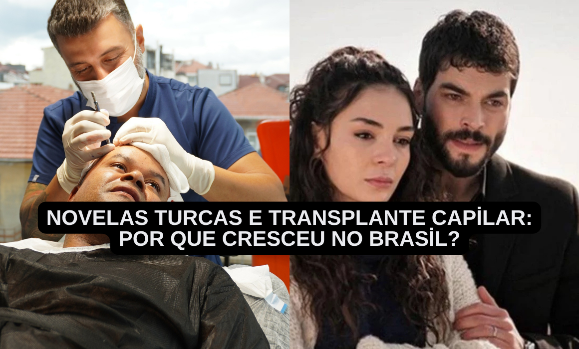 Novelas Turcas e transplante capilar: por que cresceu no Brasil?