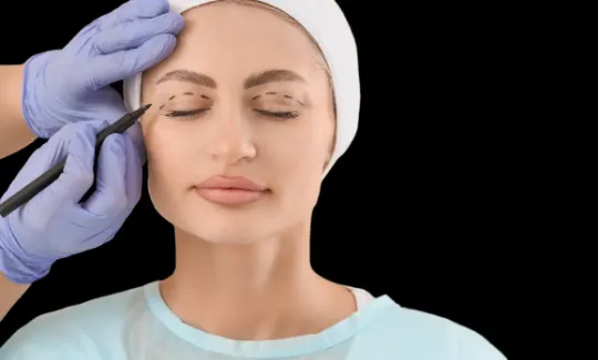 Blefaroplastia: excesso de pele tratado com incisão no sulco da pálpebra