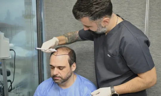 Agendar transplante capilar: passo a passo para marcar sua data