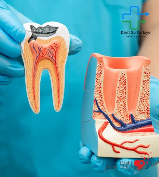 O tratamento de canal é feito quando a cárie ou infecção atinge a polpa do dente.
Objetivo: Remover a polpa infectada, limpar o canal e preenchê-lo com material específico.
Indicação: Cáries profundas, abscessos dentários, dores prolongadas.
Vantagens: Salva o dente sem extração e previne a propagação da infecção.