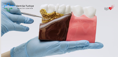 🦷 1. Começa o Sangramento da Gengiva