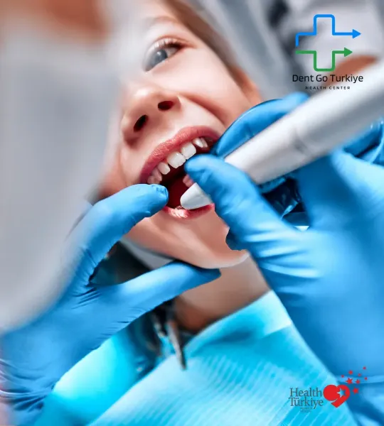 A obturação é um tratamento simples para cáries ou pequenos danos.
Objetivo: Limpar a parte cariada do dente e preencher a cavidade com material restaurador.
Indicação: Geralmente cáries iniciais ou pequenas fraturas.
Vantagens: Aplicação rápida, alívio imediato da dor e proteção do dente.