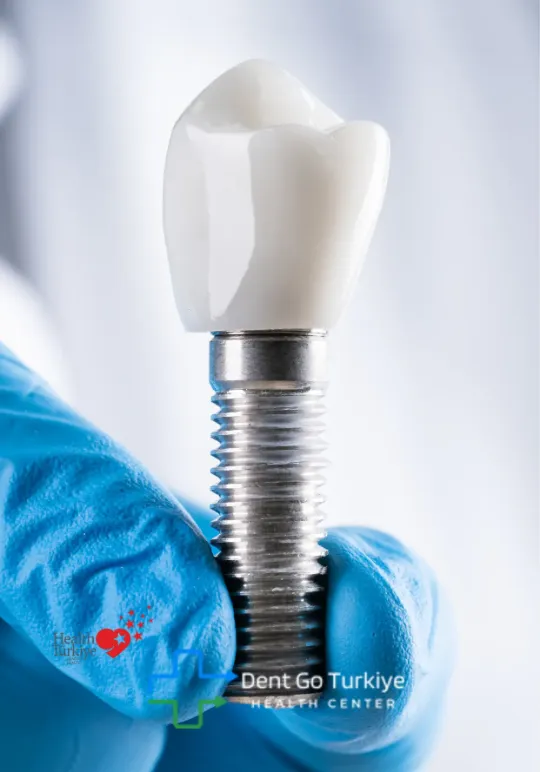 Quanto custa um implante dentário na Turquia